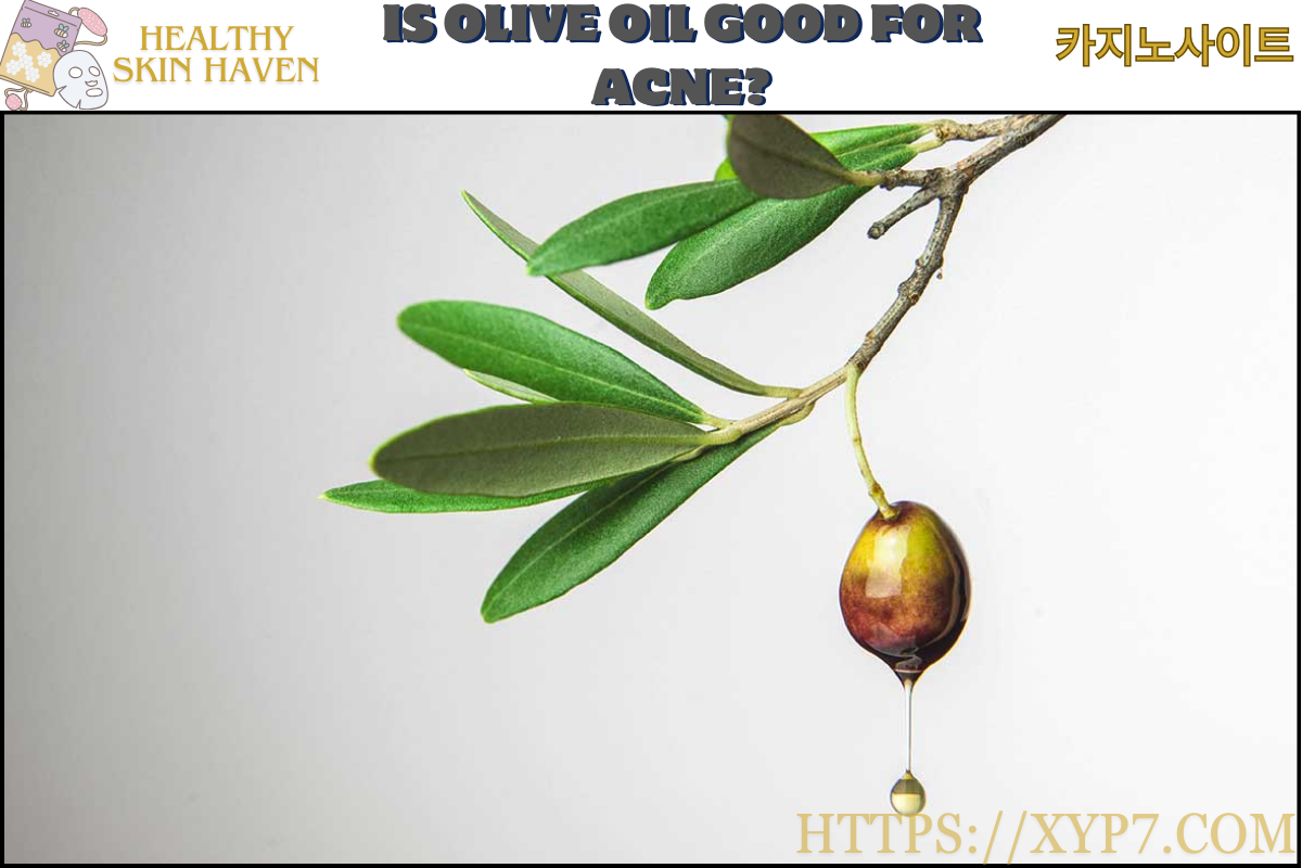 Is Olive Oil Good for Acne?